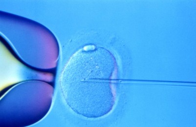 IVF
