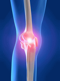 Knee Injuries Haynes Acupuncture Gold Coast