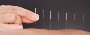 Acupuncture for a Healthy Balanced Life