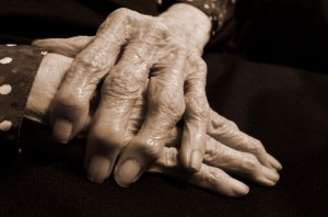 Rheumatoid Arthritis