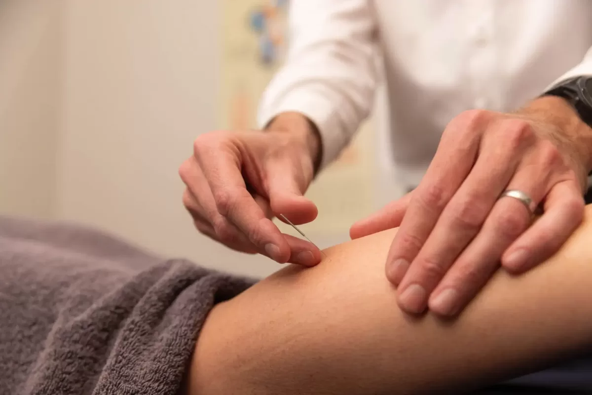 Gold Coast acupuncture treatment on client’s leg