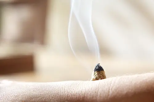 Moxibustion 2