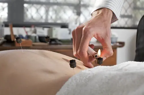 Moxibustion 3