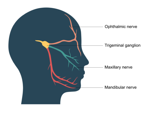 Acupuncture in the Management of Trigeminal Neuralgia