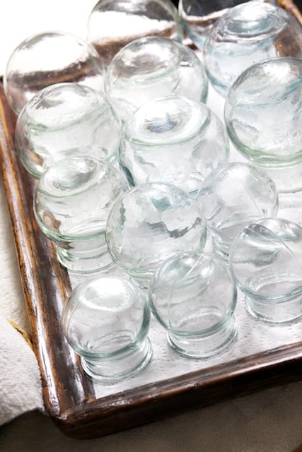 Chinese Cupping Therapy