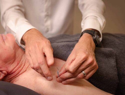 Dry Needling and the Mechanism of Acupuncture: What You Need to Know