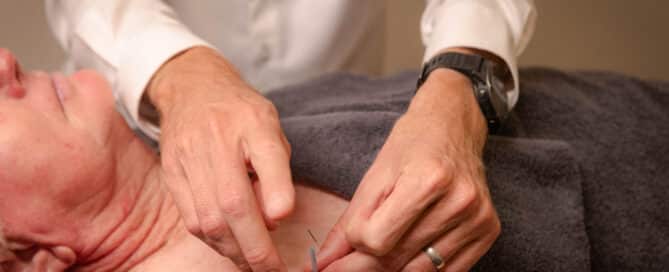 Dry needling