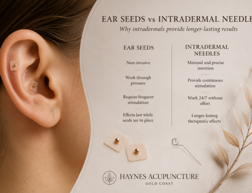 Ear Seeds vs Intradermal Needles: Why Intradermal Acupuncture Provides Longer-Lasting Results